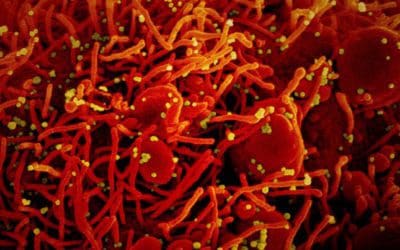 A Covid-19 vaccine, amazingly, is close. Why am I so worried? – STAT